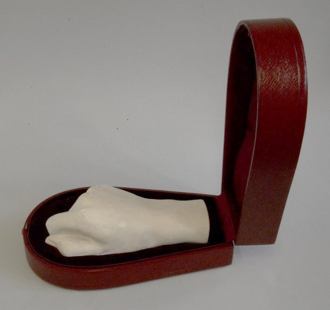 The cast of Thackeray’s hand in its original red leather case